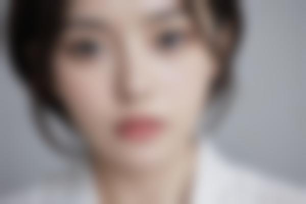 4、静萍胎记疤痕修复术后指导