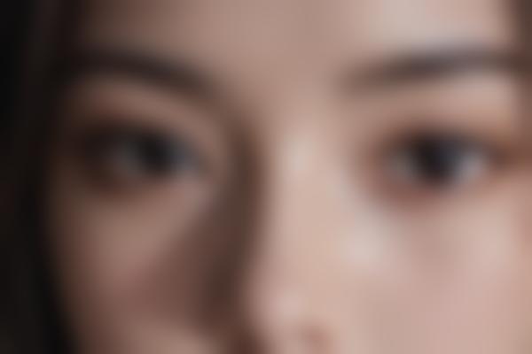 静萍胎记疤痕修复价格多少？