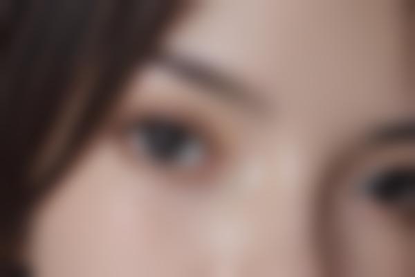 3、奥美定取出修复技术
