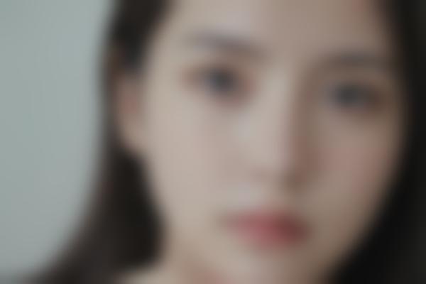 为什么选择长春廉娜医疗美容做馒化脸修复？