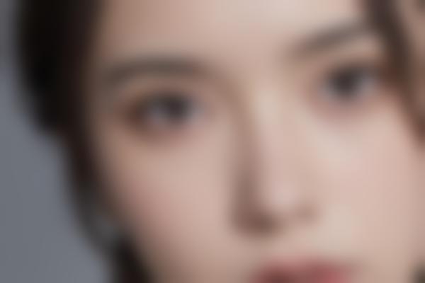 3、付俊俐医生鼻整形持久自然