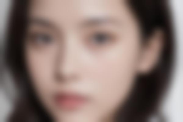 太原华晋医院整形科郭霞医生解析,眼部鼻部综合塑美值得信赖!