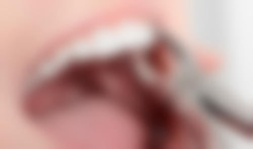 永康董君瑞口腔诊所价格收费