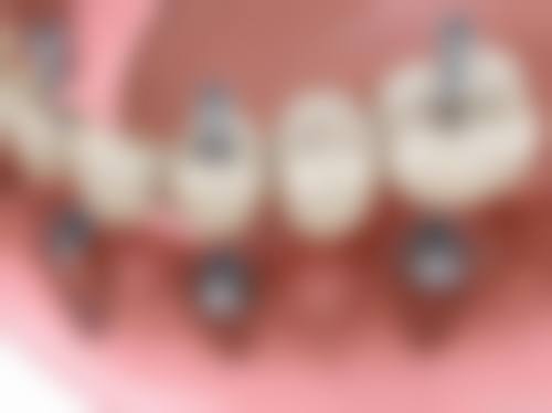 江西九江欣康口腔门诊部价格收费