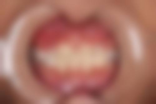 广东广州岗城口脸的价格收费