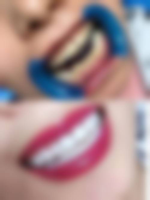 南昌玖玖口腔诊所价格收费