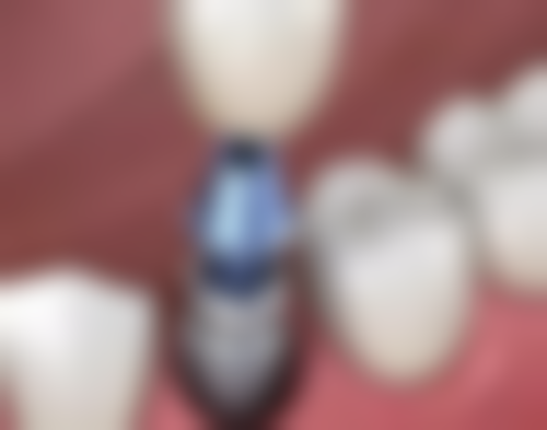 临沂合美口腔门诊部技术优势