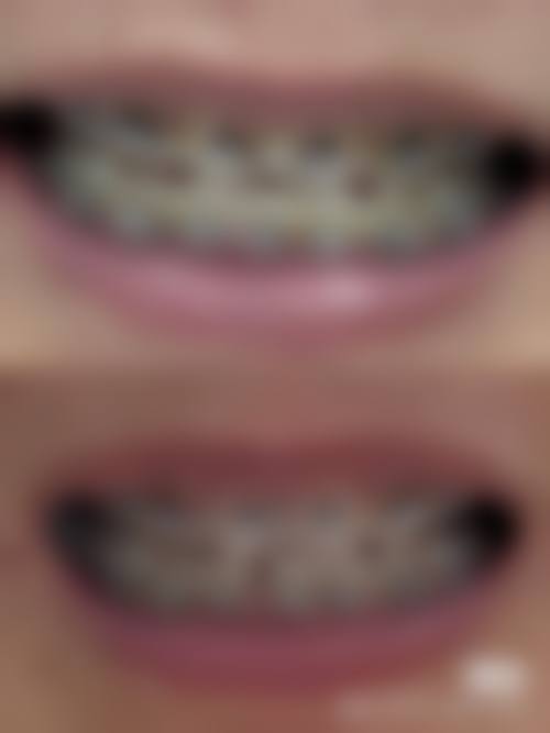 临沂合美口腔门诊部患者口碑