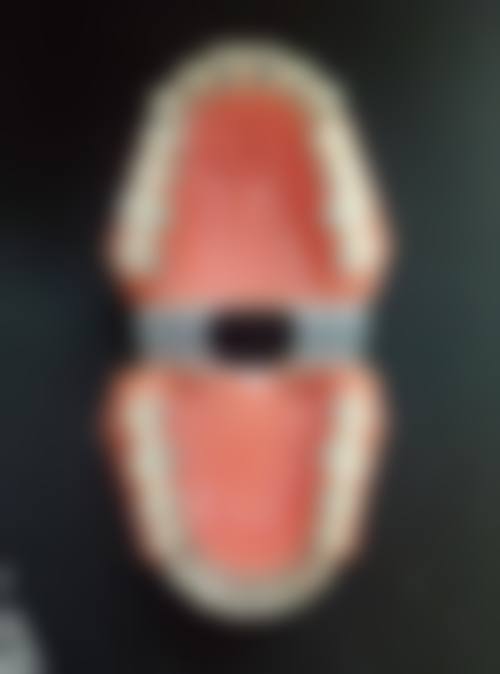 广西桂林卓越口腔的价格收费