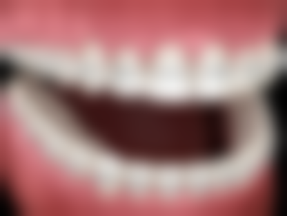 兴义市人民医院口腔二科价格收费