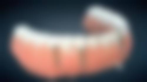 深圳益珺毅君口腔门诊部的价格收费