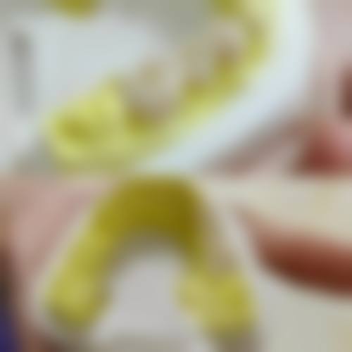 温州乐清王者口腔患者口碑