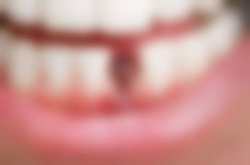 广州曙光医学美容医院牙科中 心技术优势