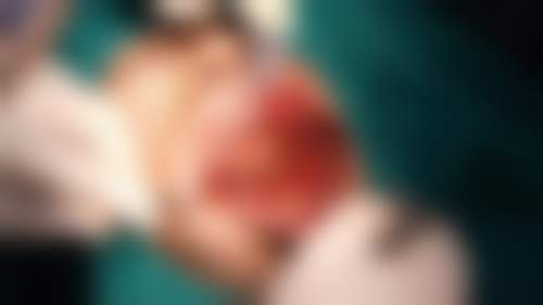 深圳润发口腔的价格收费