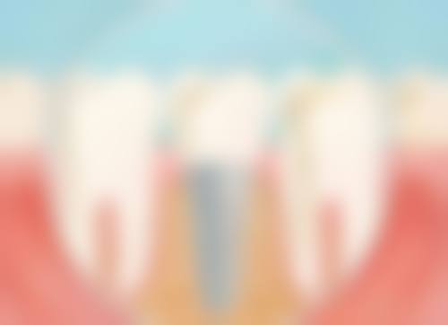 盐城阜宁县齿康口腔门诊部价格收费