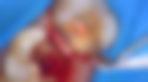 新疆吐鲁番高昌区木拉丁口腔的患者口碑