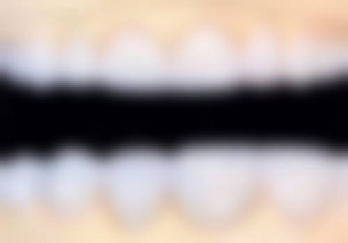 河北石家庄无极牙乐美口腔的价格收费