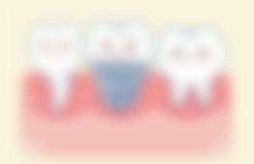 重庆渝北彭开春口腔技术优势