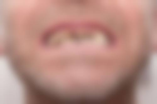 杭州明嘉齿科患者口碑