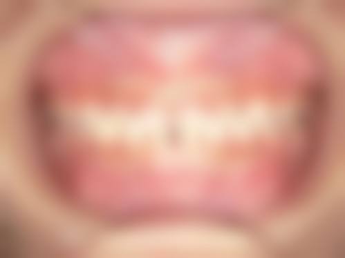 戚孟春的临床实战与真实实例