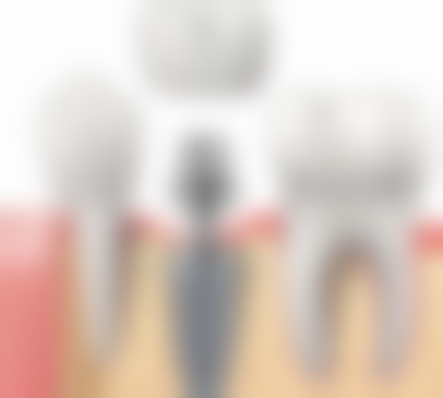 广东东莞横沥格林德口腔的来院路线