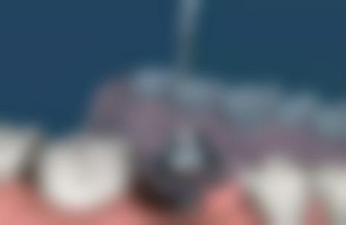 武汉德亚口腔医院患者口碑