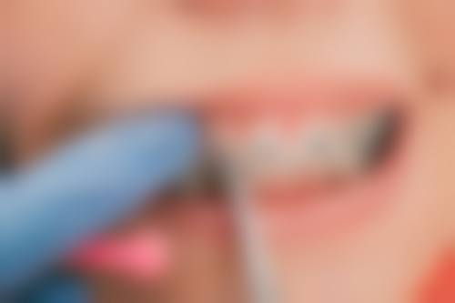 温州立禾口腔的价格收费