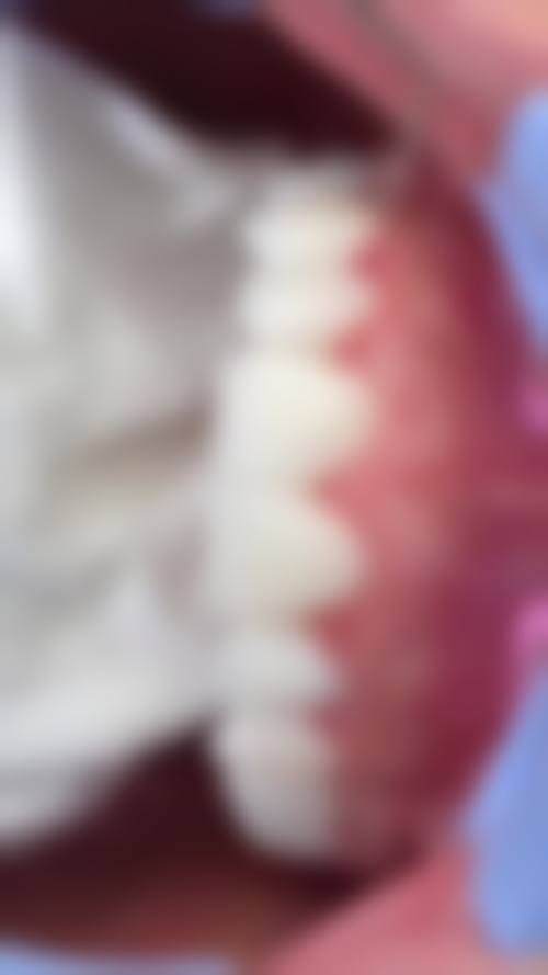 东莞恒好汇一城口腔来院路线