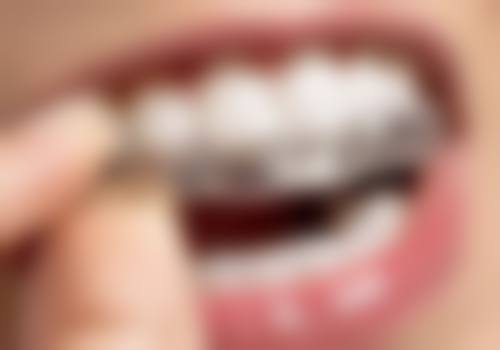 北京维尔口腔医院西城诊所的技术优势