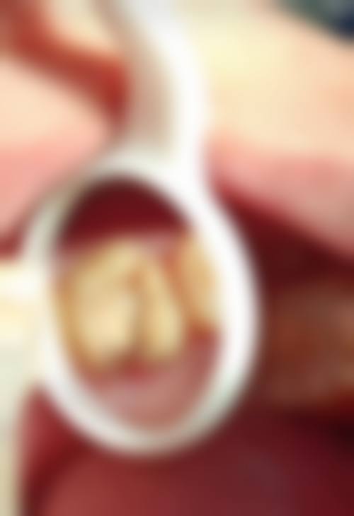 深圳新张近新口腔诊所患者口碑