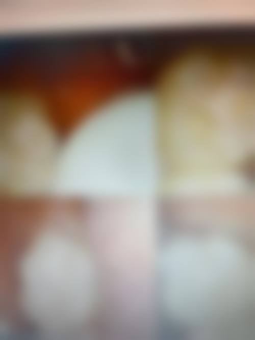 中山展盈口腔价格收费