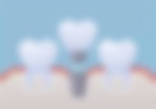 利智口腔技术优势