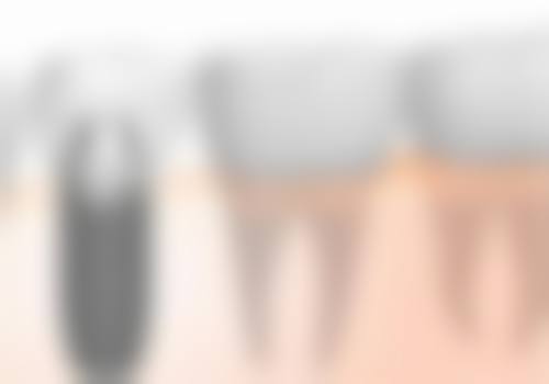 韩国沃科斯牙科医院患者口碑