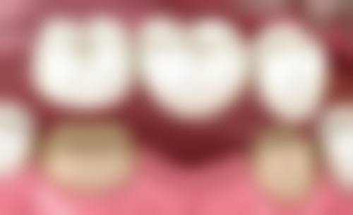 泉州丰泽植德口腔正规资质