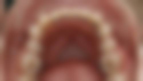 嘉兴一诺口腔门诊部的价格收费