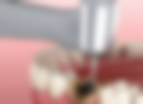 杨素 的临床实战与个性化诊疗