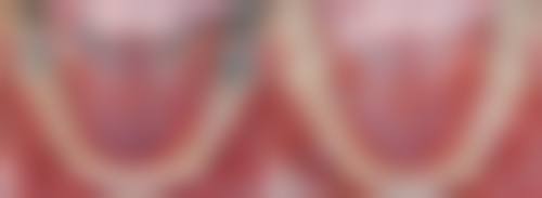 常州金坛曹雨秋口腔门诊部专精医师团队