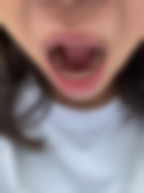 曹玉飞的收费标准与就诊指引