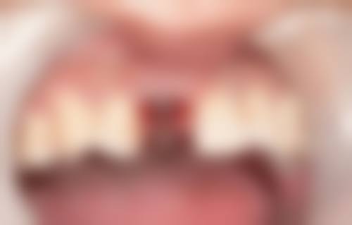 甘肃庆阳李晓龙口腔诊所诊疗服务优势