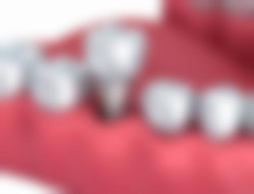 姚森的临床实战与个性化诊疗