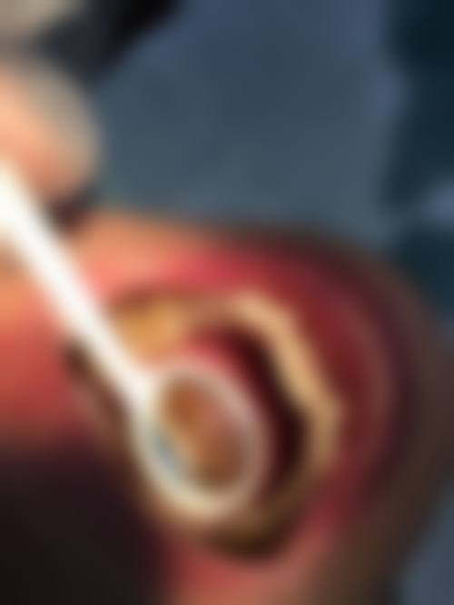 甘肃庆阳李晓龙口腔诊所特色诊疗技术盘点