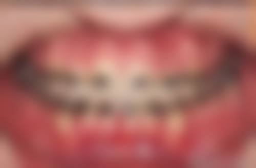 常研燕的临床实战与个性化诊疗