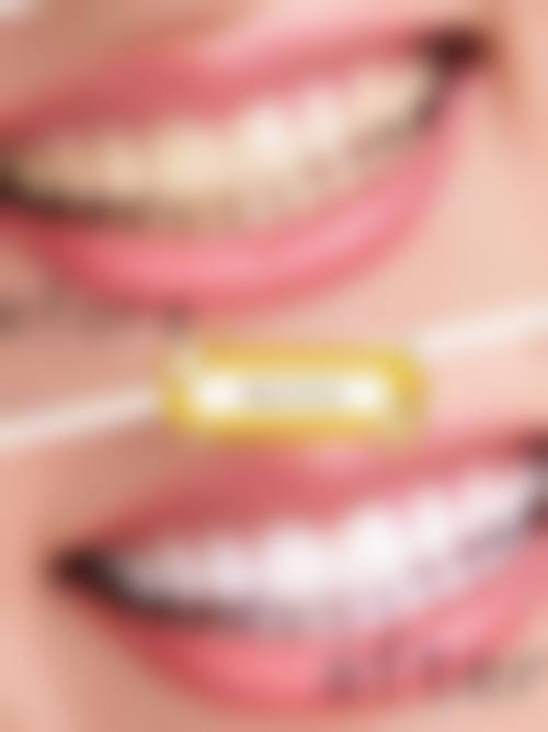 广西微笑口腔门诊部收费标准