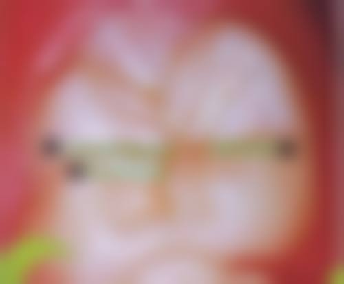 三明梅列十博悦口腔门诊部患者真实口碑