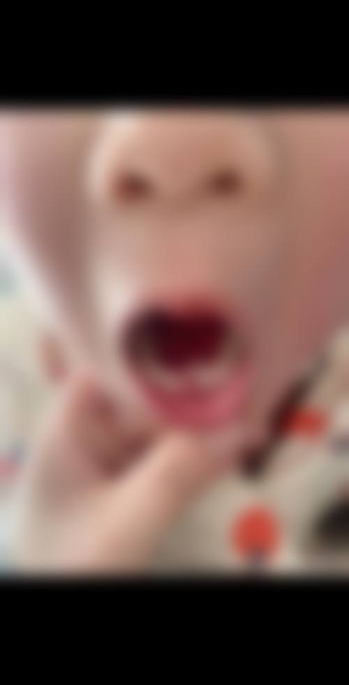 唐礼兴的临床实战与个性化诊疗