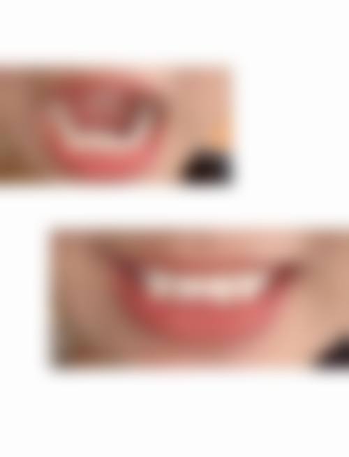 叶菁的临床实战与真实实例