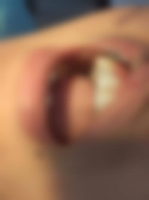 宝鸡岐山贝达口腔门诊部预约方式