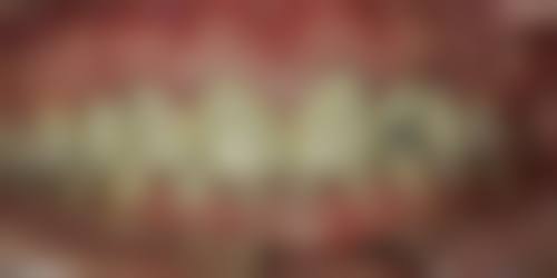 山东济宁汶上杨东红口腔特色诊疗技术