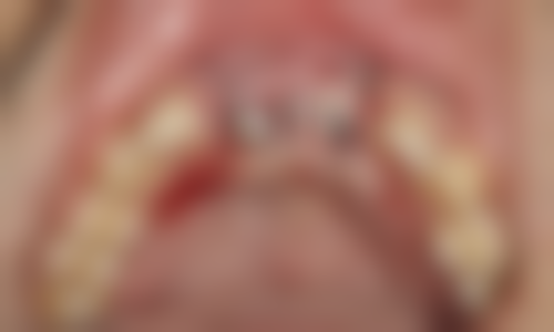 深圳鼎植口腔医院(罗湖口岸旗舰店)具有影响力资质认证