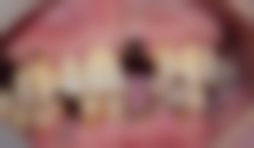 许海磊的临床实战与个性化诊疗